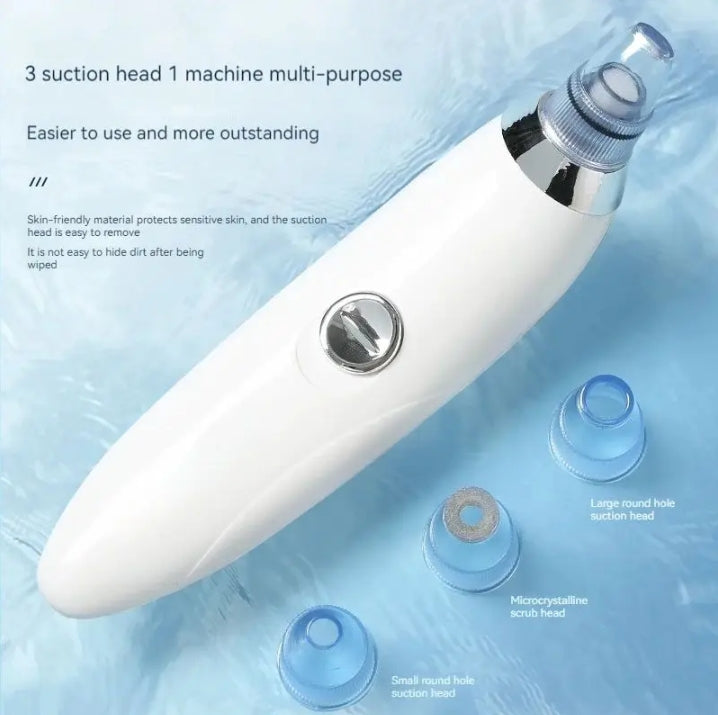 Vaccum Black & White Heads Remover Pimple Suction Beauty Tool