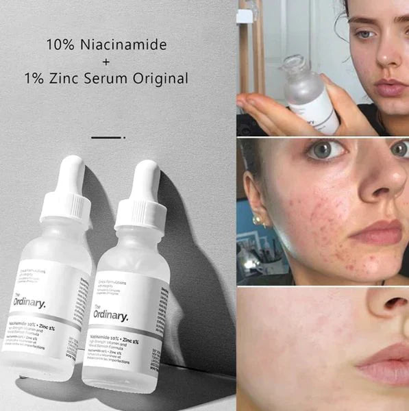 The Ordinary Niacinamide 10% + Zinc 1%